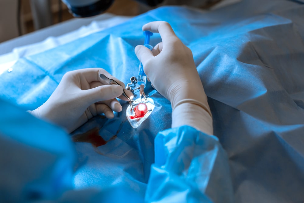 Professional ophthalmologist performing delicate eye surgery using a surgical microscope in a clinical operating room setting.